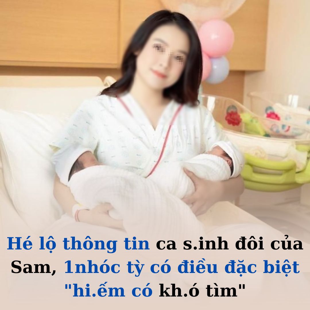 Sam s:inh đôi, hé lộ những hình ảnh đầu tiên về hai nh.óc t.ỳ