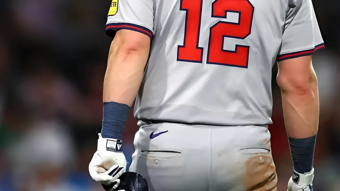 Red Sox fans will be grossed out by Braves catcher's injury after HBP