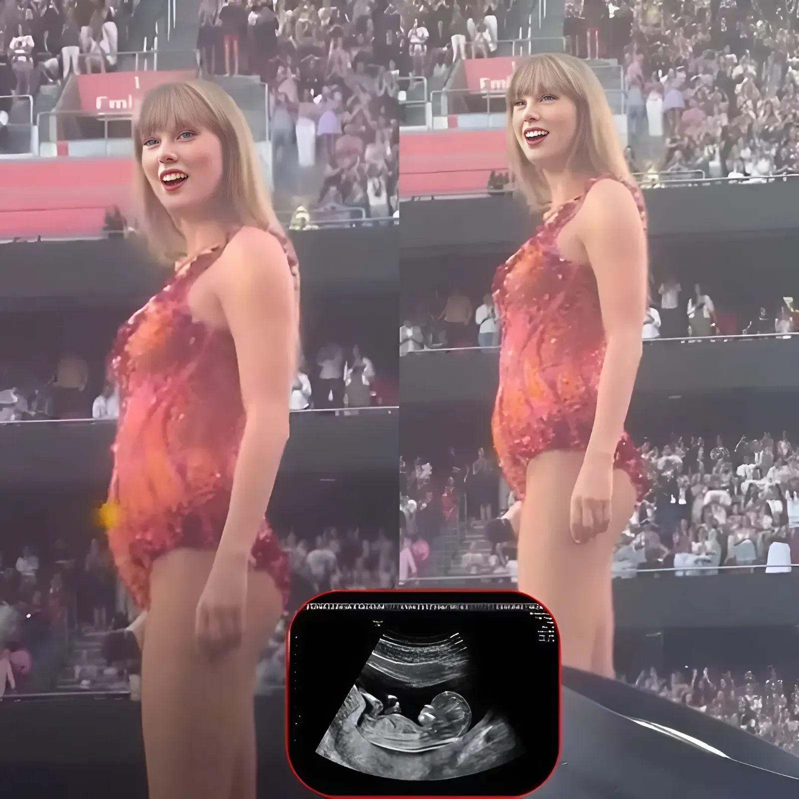 Taylor Swift "baby bump" video from Eras Tour fuels rumor that she's pregnant with Travis Kelce's child...