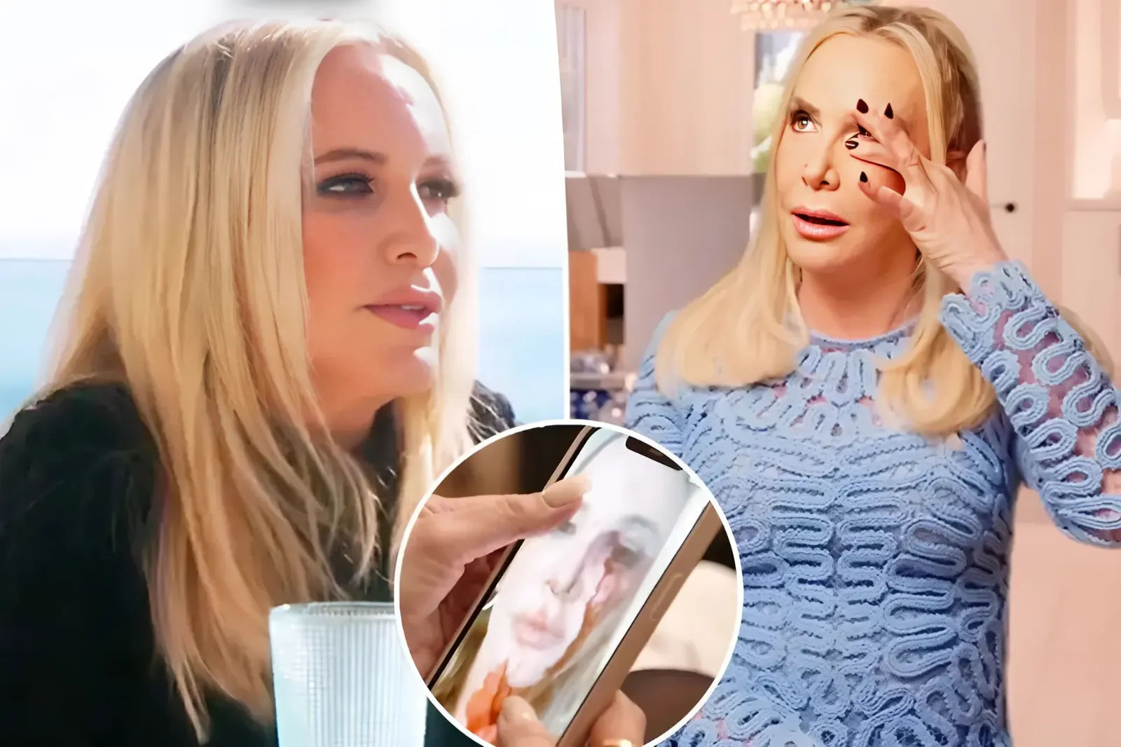 See shocking photo of Shannon Beador’s bloodied face after DUI accident