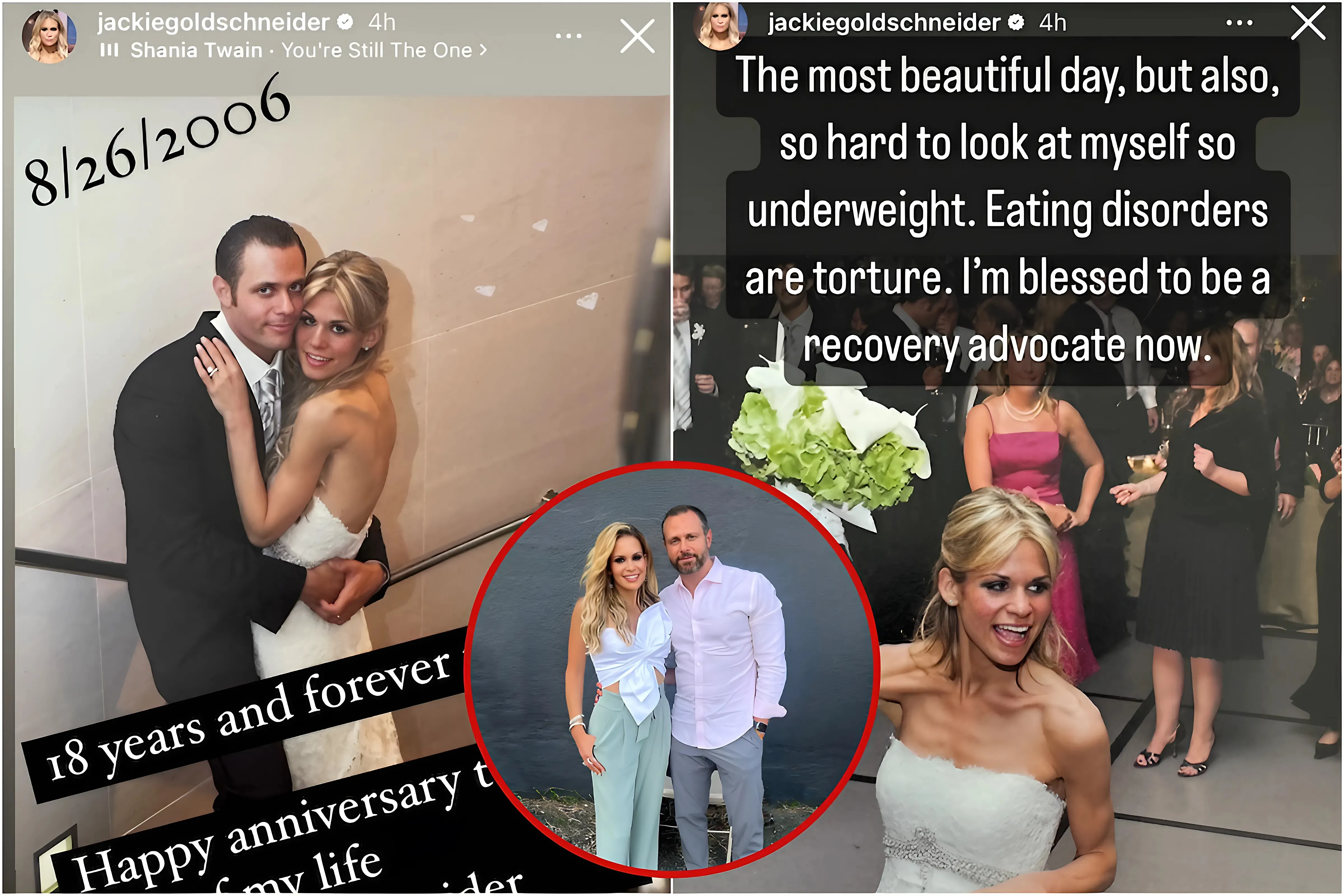 RHONJ's Jackie Goldschneider Opens Up: Reveals 'Underweight' Wedding Photos, Battles ED, and Addresses Rumors About Podcast Ending with Jennifer Fessler! trucc