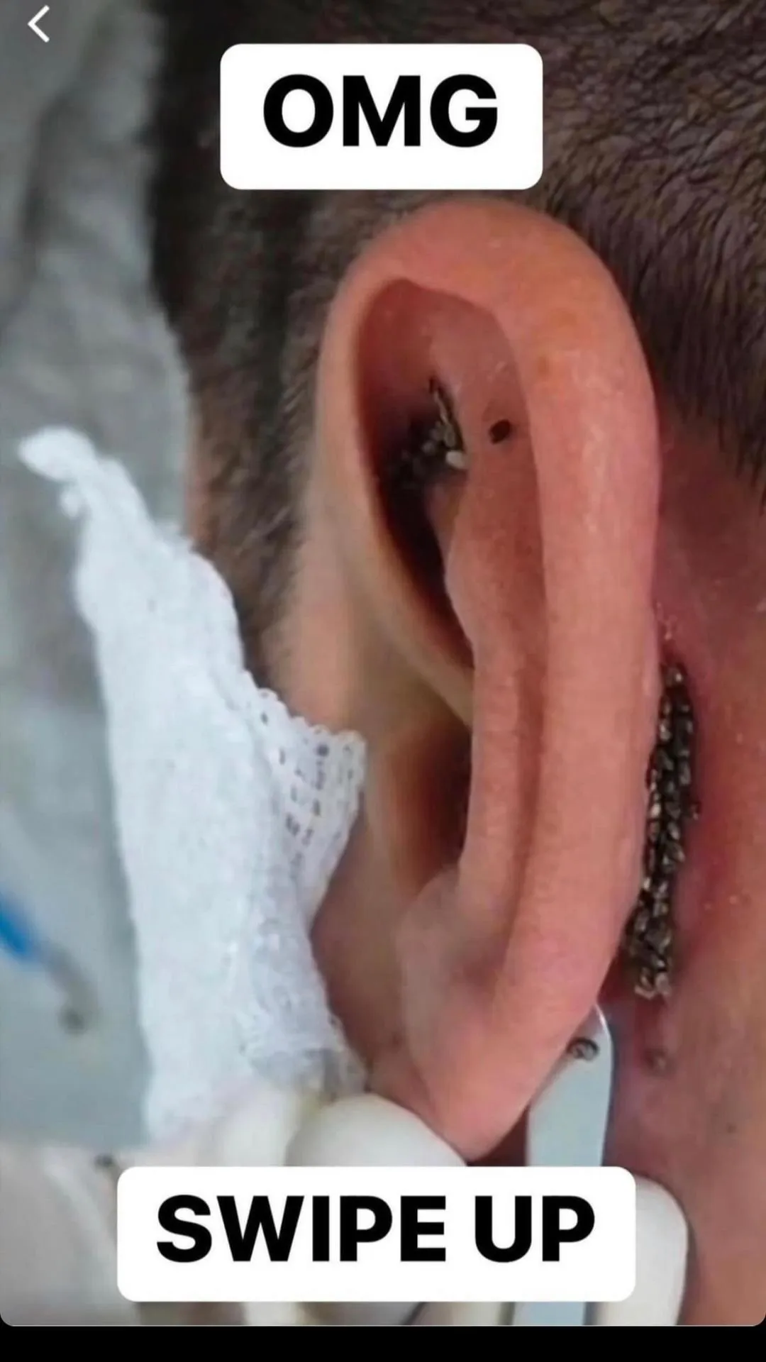 ST. Ear Infection: 6 Signs You Have It ST. Ear Infection: 6 Signs You Have It