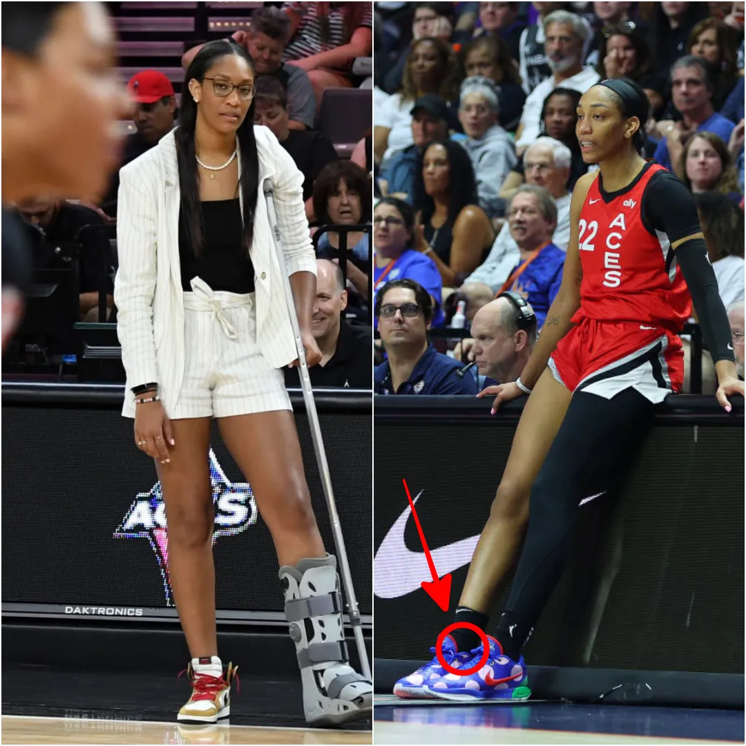 Aces star A’ja Wilson sits out game against Liberty with painful injury that all athletes fear
