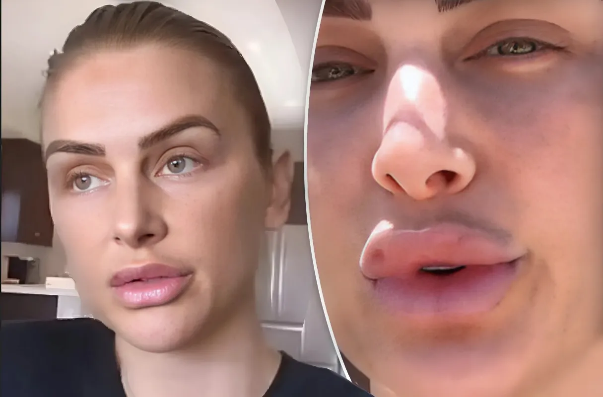 Lala Kent shows off her plump pout after getting her filler touched up and claps back at critics: 'What my face is poked with does not affect you - lulu