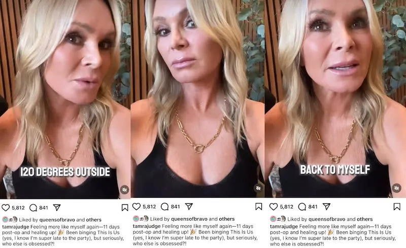 PHOTOS: RHOC’s Tamra Judge Debuts Healed New Face After $15K Brow Lift and Chemical Peel as Fans Claim She Looks the Same, Plus She Removes Hair Extensions