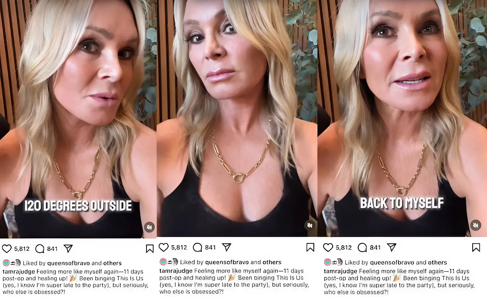 RHOC’s Tamra Judge Debuts Healed New Face After $15K Brow Lift and Chemical Peel as Fans Claim She Looks the Same, Plus She Removes Hair Extensions