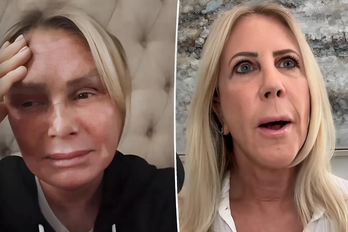 Vicki Gunvalson calls ex-friend Tamra Judge a ‘good actress’ after crying video: ‘There were no tears’