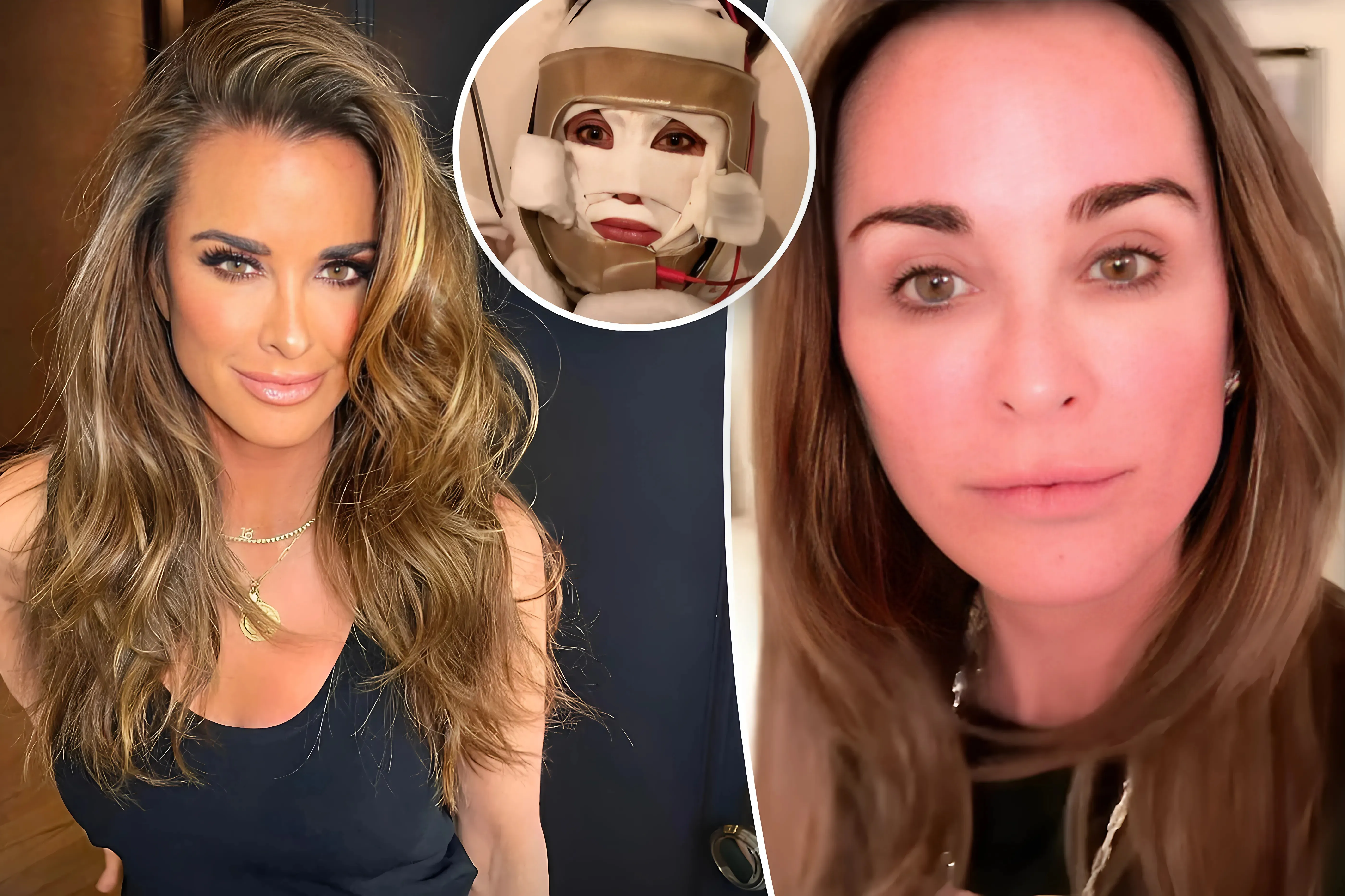 "Kyle Richards strongly responds to rumors about his salary at RHOBH, and also attracts attention with a scary facial electric treatment – ​​see the series of photos now!"