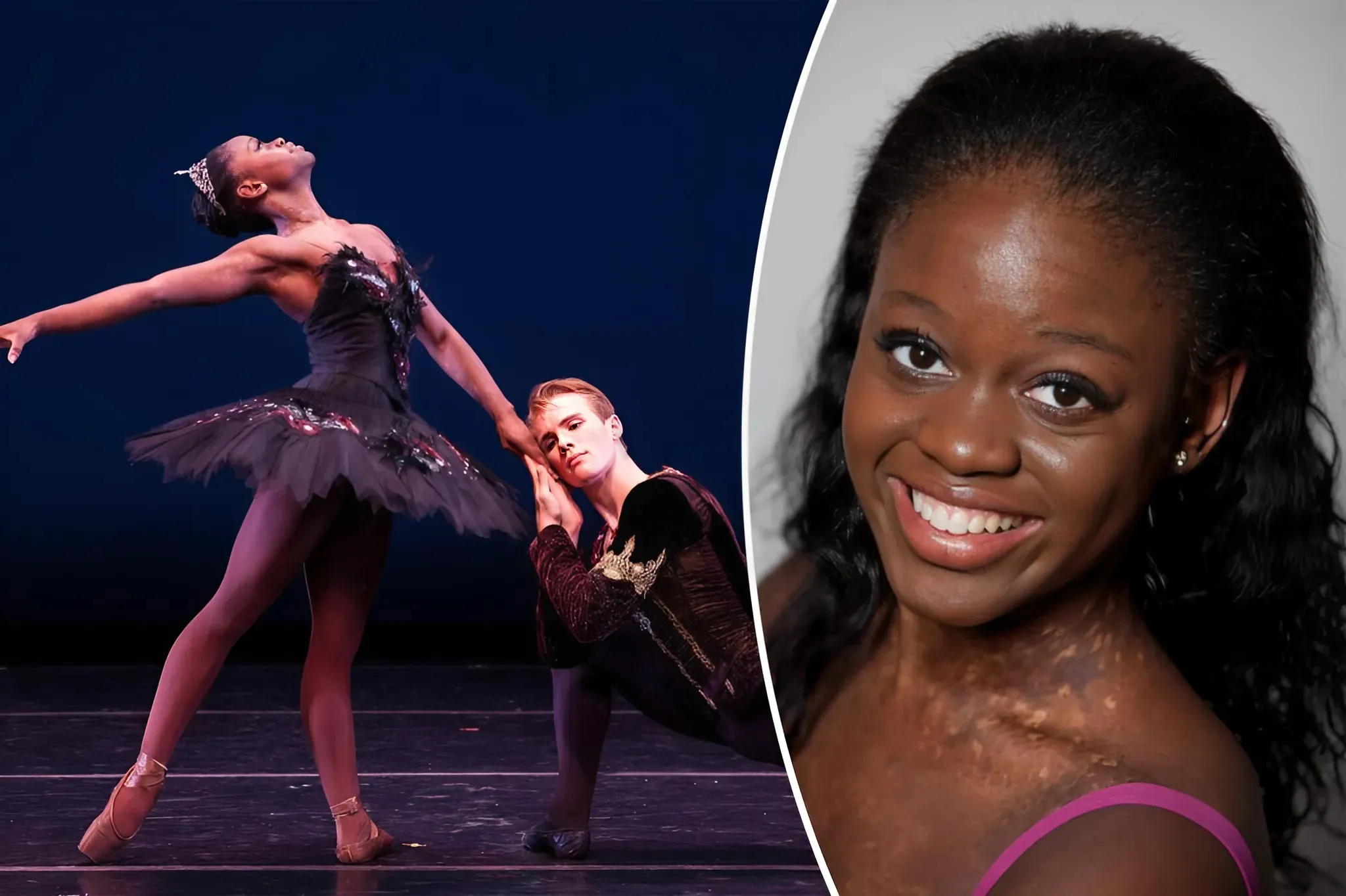 'Tragedy Strikes: Ballerina Michaela DePrince, Known for Performances with Beyoncé and on 'DWTS,' Passes Away at 29' trucc