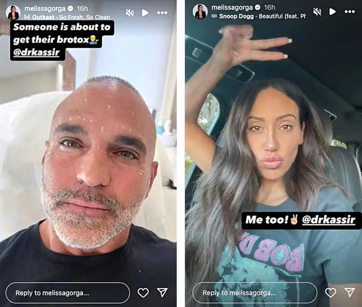 Melissa Gorga and Joe Take You Inside Their Date Night, Complete with Botox (PHOTOS)