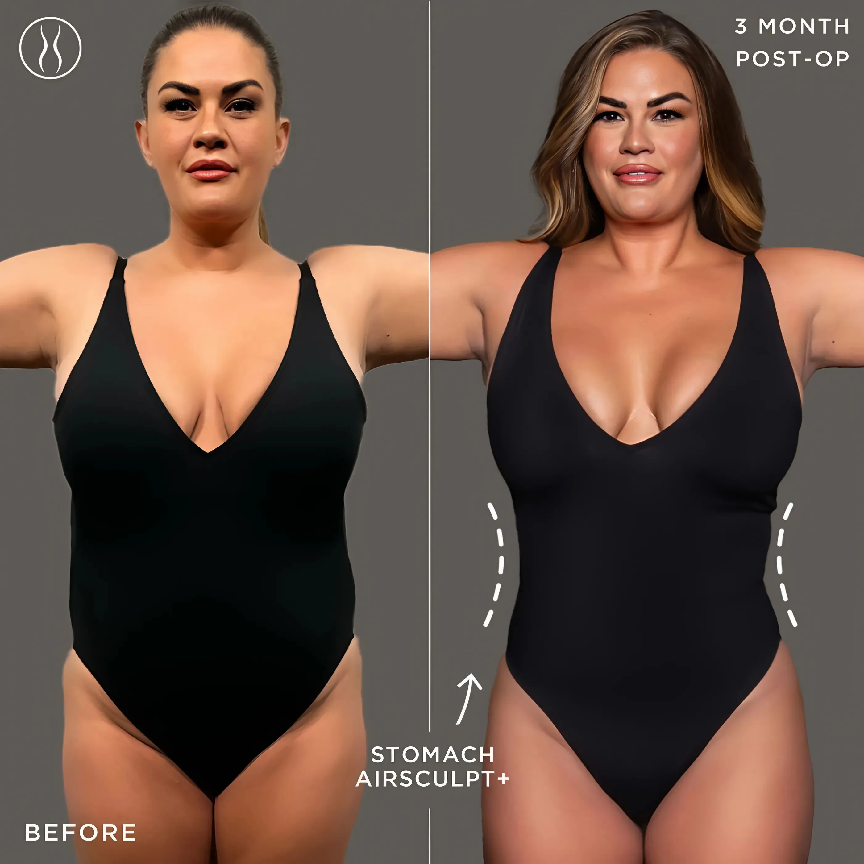 Brittany Cartwright Shares Which Cosmetic Procedure Gave Her a 'Confidence Boost’ amid Jax Taylor Divorce (Exclusive)