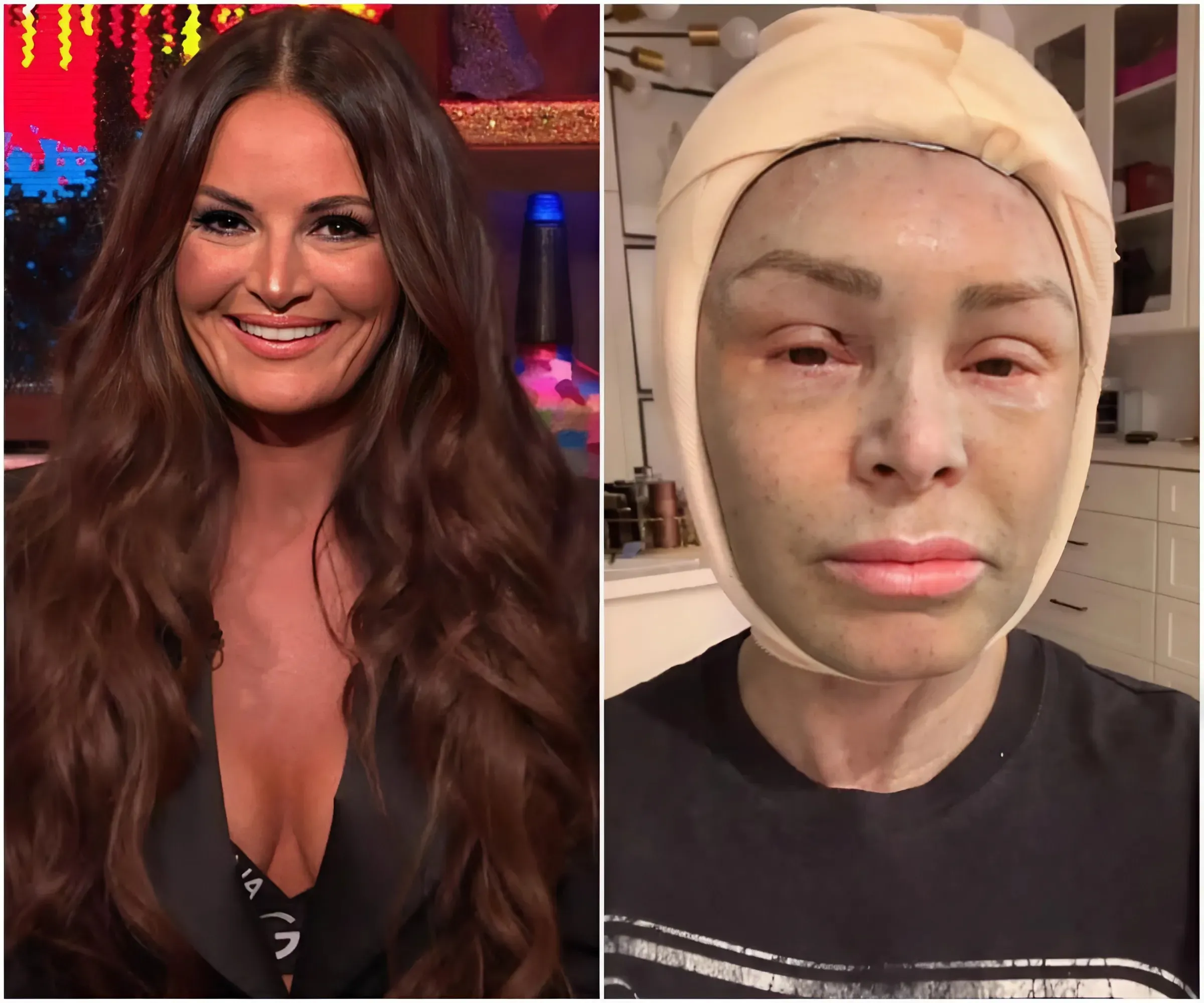 Lisa Barlow Unexpectedly Reveals Plans to Get a Daring Cosmetic Procedure Like Tamra Judge – The Daring Behind This Shocking Decision and the Unexpected Consequences - suong