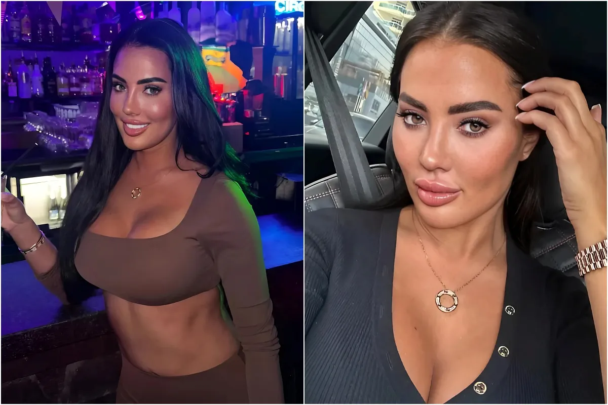 Towie star Yazmin Oukhellou dissolves 10 years of filler from face as fans say ‘you look stunning now’ liennhi