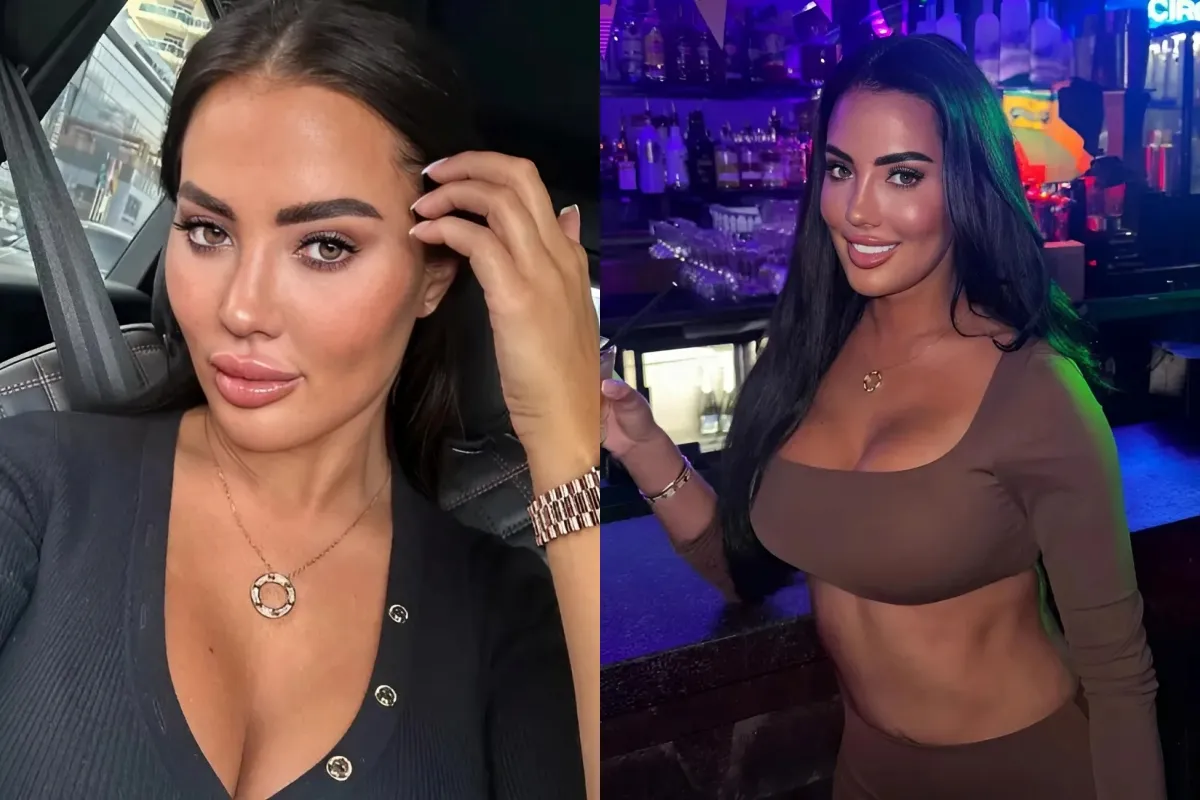 Towie star Yazmin Oukhellou dissolves 10 years of filler from face as fans say ‘you look stunning now’ ngocc