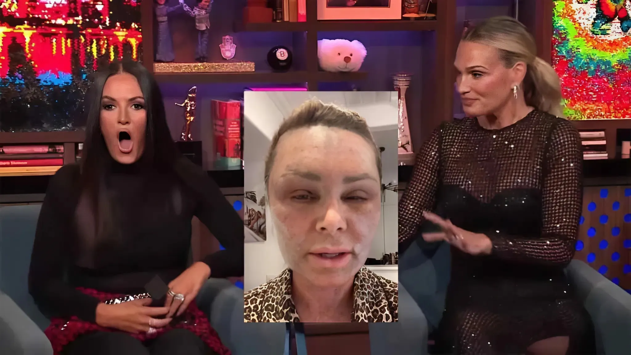 Lisa Barlow Talked Out of Getting Same Laser Procedure as Tamra Judge