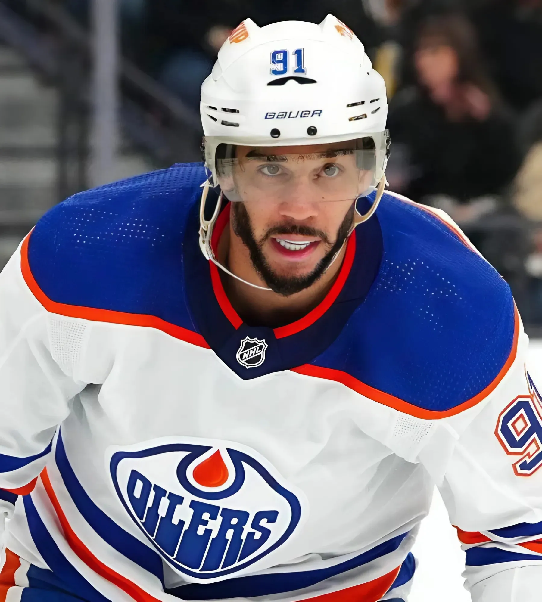 Oilers’ Evander Kane expected to miss five to six months after abdominal surgery