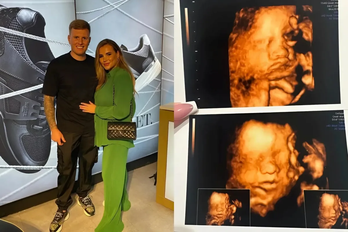 Towie’s Tommy Mallet and Georgia Kousoulou reveal they’re having a baby girl after he opened up about losing £4million ngocc