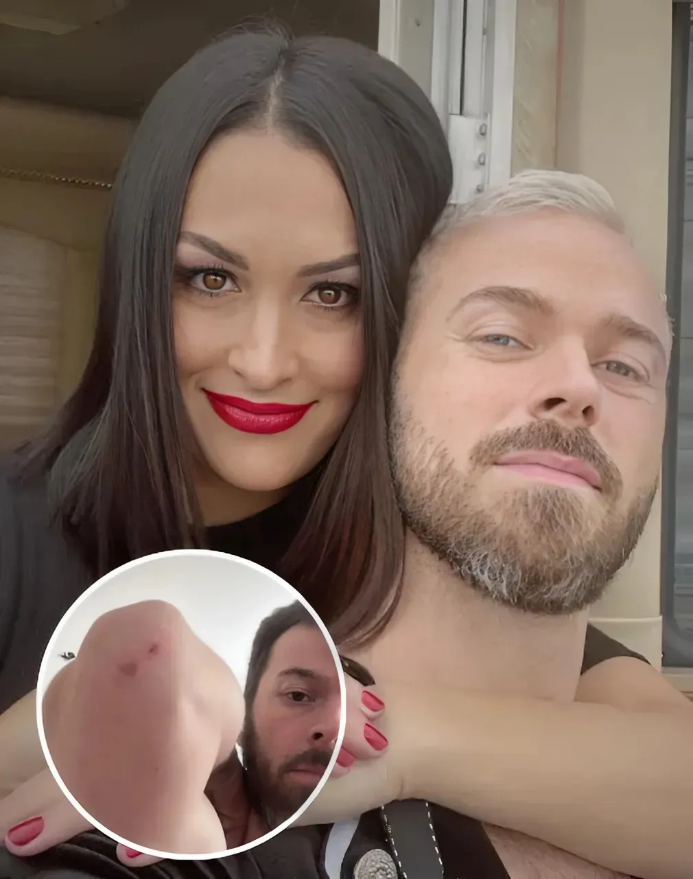 Artem Chigvintsev claims estranged wife Nikki Garcia was the abuser, shows off bloody scratches on arms, neck