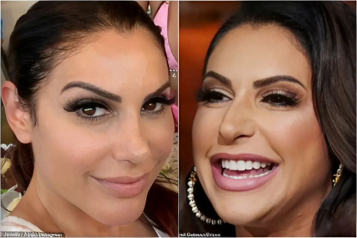 RHONJ star Jennifer Aydin gets chin implant REMOVED after 'struggling' to accept her altered jaw seven months after plastic surgery makeover in Turkey