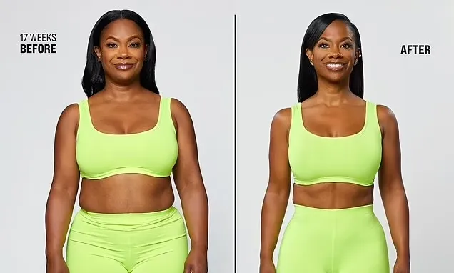 'RHOA' Star Flaunts Major Weight Loss After Taking Controversial Supplement in Before and After Photos