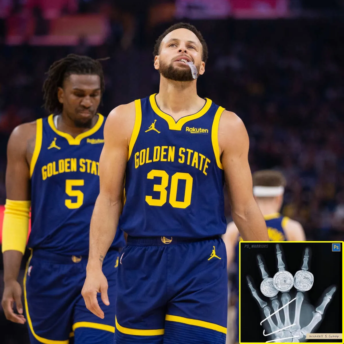 Warriors Reveal Final Results of Steph Curry’s X-Ray to Shooting Hand