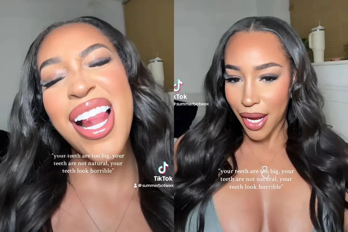 Love Island star hits back after being cruelly trolled over ‘huge, unnatural’ brand new teeth in new video ngocc