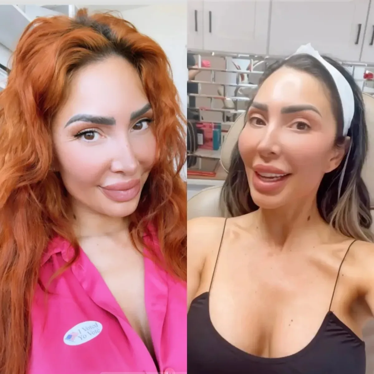 ‘Teen Mom’ Fans Horrified Over Farrah Abraham’s New Botched Face