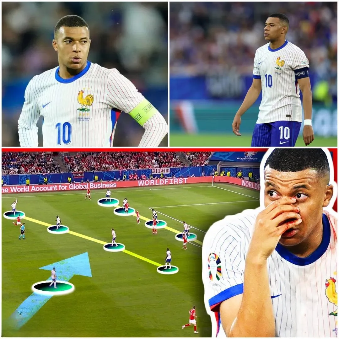 Cómo puede Francia arreglárselas sin Kylian Mbappé