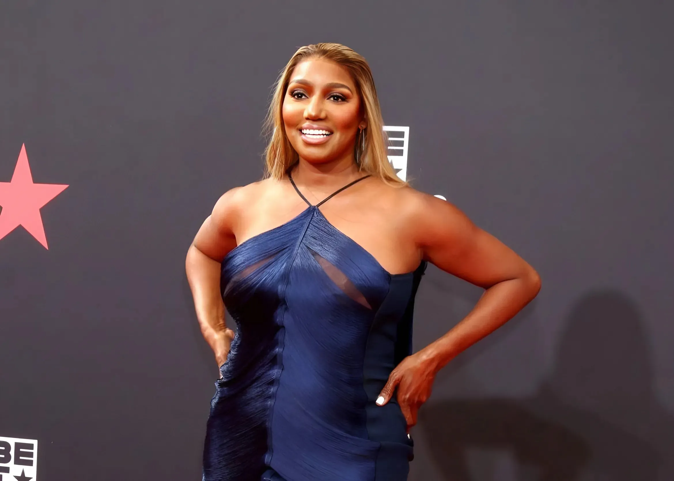 RHOA Alum Nene Leakes is Deemed “Unrecognizable” After New Photo Goes Viral and Prompts Plastic Surgery Rumors