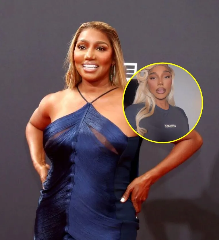 RHOA Alum Nene Leakes is Deemed “Unrecognizable” After New Photo Goes Viral and Prompts Plastic Surgery Rumors