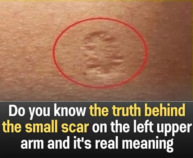 True Meaning Behind the Tiny Scar on Your Upper Left Arm!”