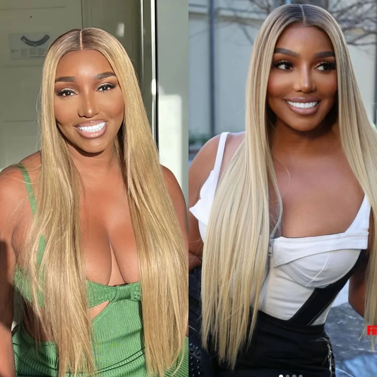 Real Housewives of Atlanta Alum NeNe Leakes Looks Unrecognizable in New Pic, Plastic Surgeon Weighs In