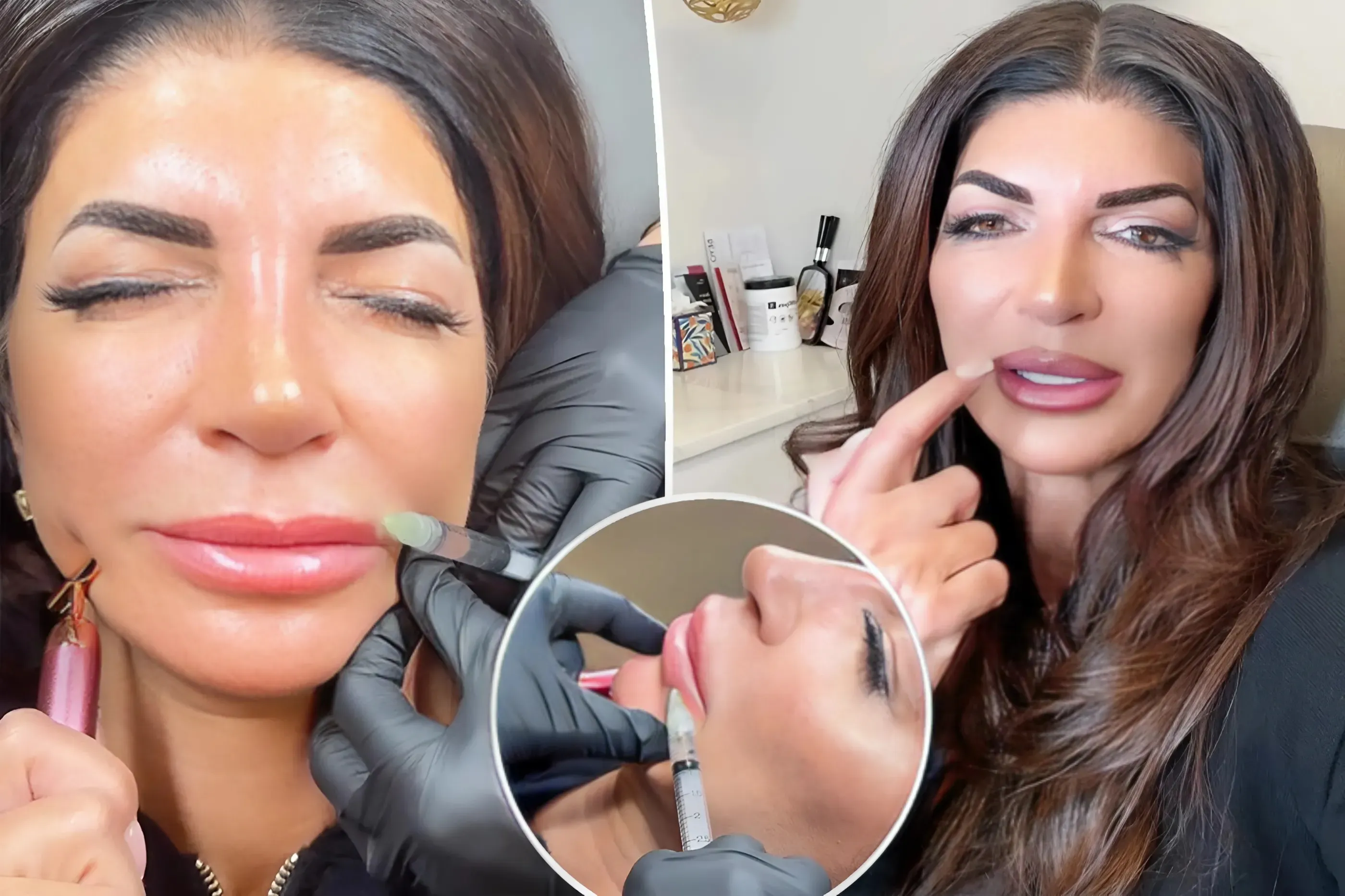 Teresa Giudice reveals she is dissolving her lip filler after backlash over her appearance