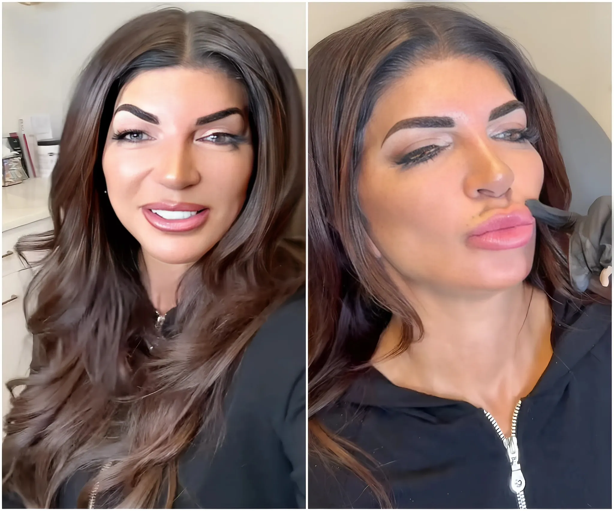 RHONJ’s Teresa Giudice Got Her “Hot Dog” Lips