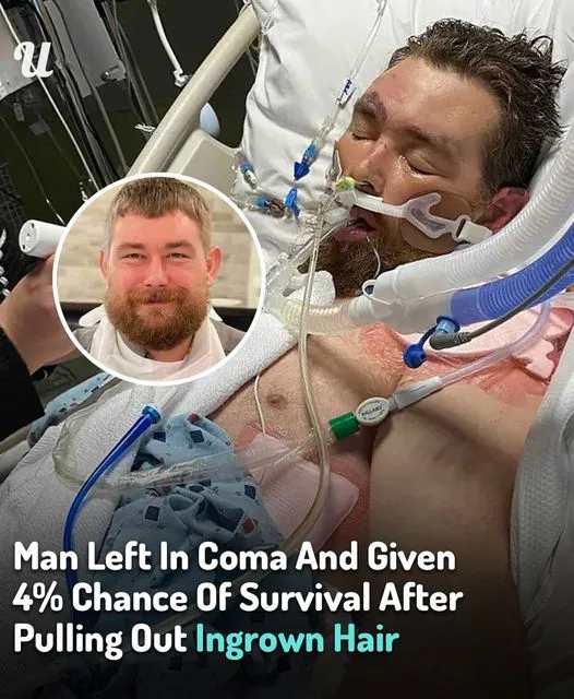 Man Left In Coma And Given 4% Chance Of Survival After Pulling Out Ingrown Hair