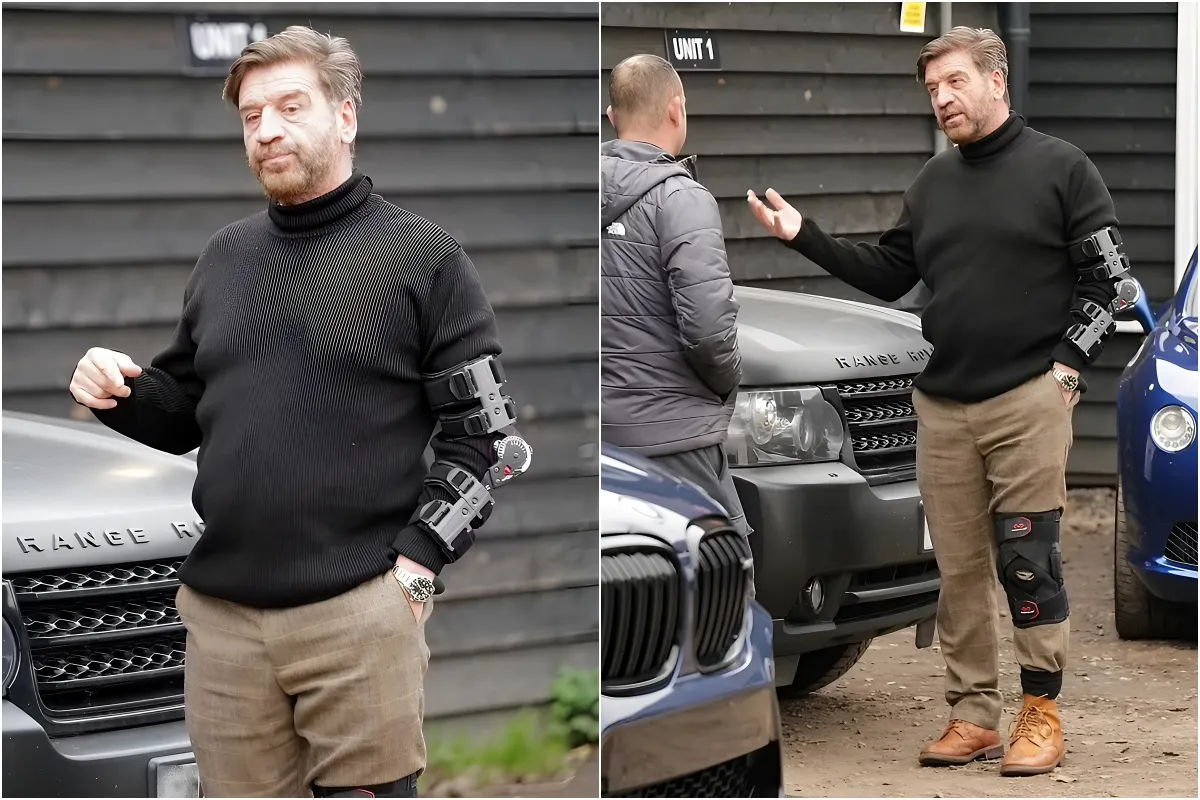 Nick Knowles cuts a glum figure as he sports an arm AND leg brace after suffering string of injuries during his Strictly Come Dancing stint liennhi