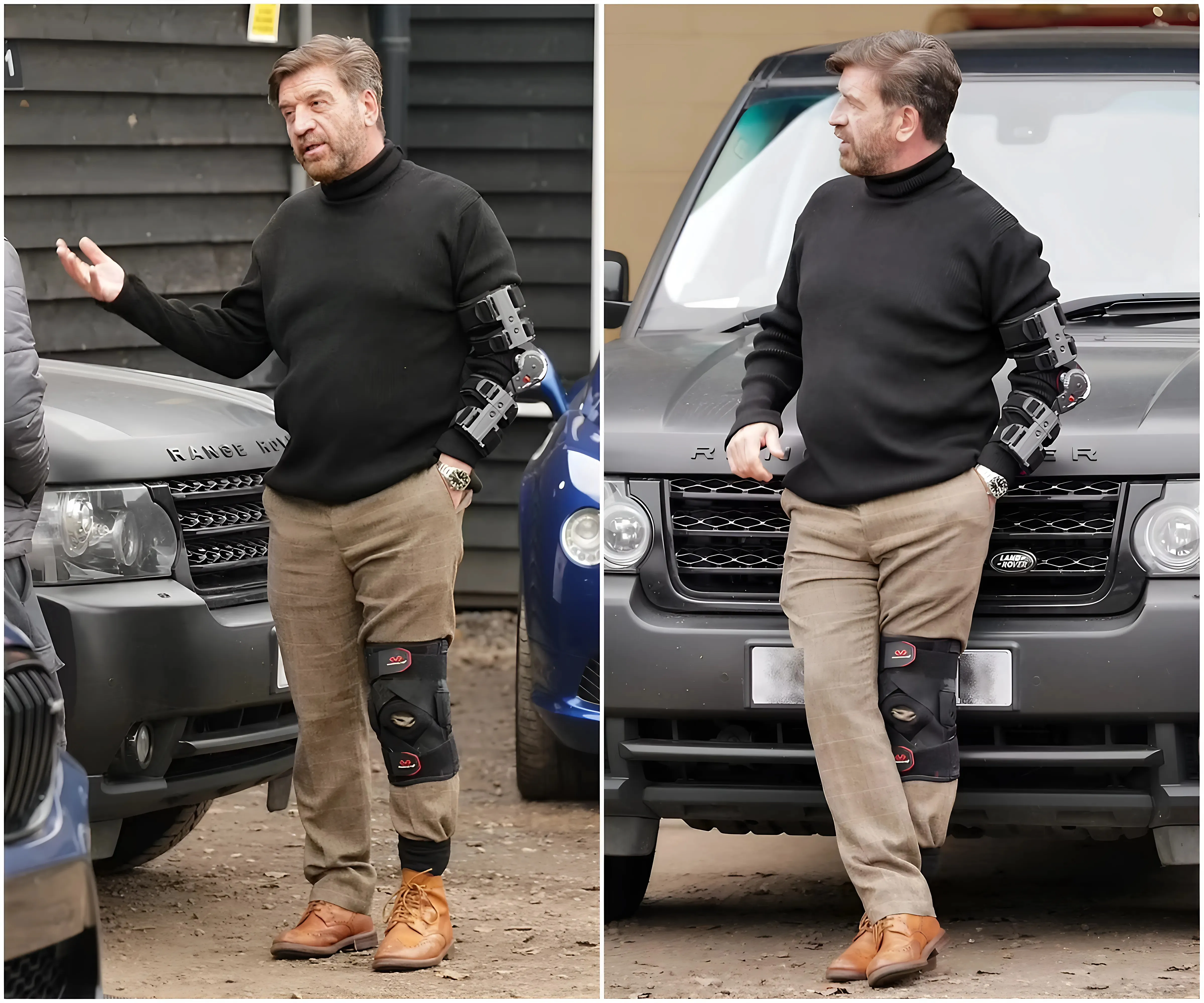 Nick Knowles cuts a glum figure as he sports an arm AND leg brace after suffering string of injuries during his Strictly Come Dancing stint - suong