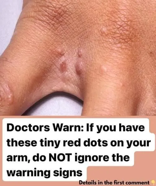 If You Have These Tiny Red Dots On Your Arm, Do Not Ignore The Warning Signs