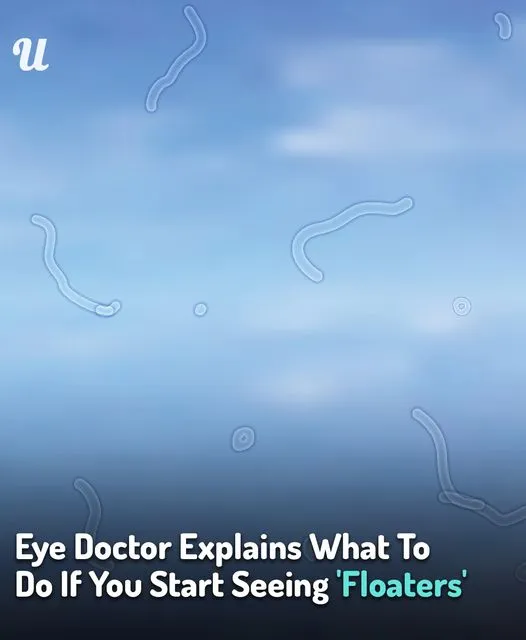 Eye Doctor Reveals What To Do If You Start Seeing ‘Floaters’