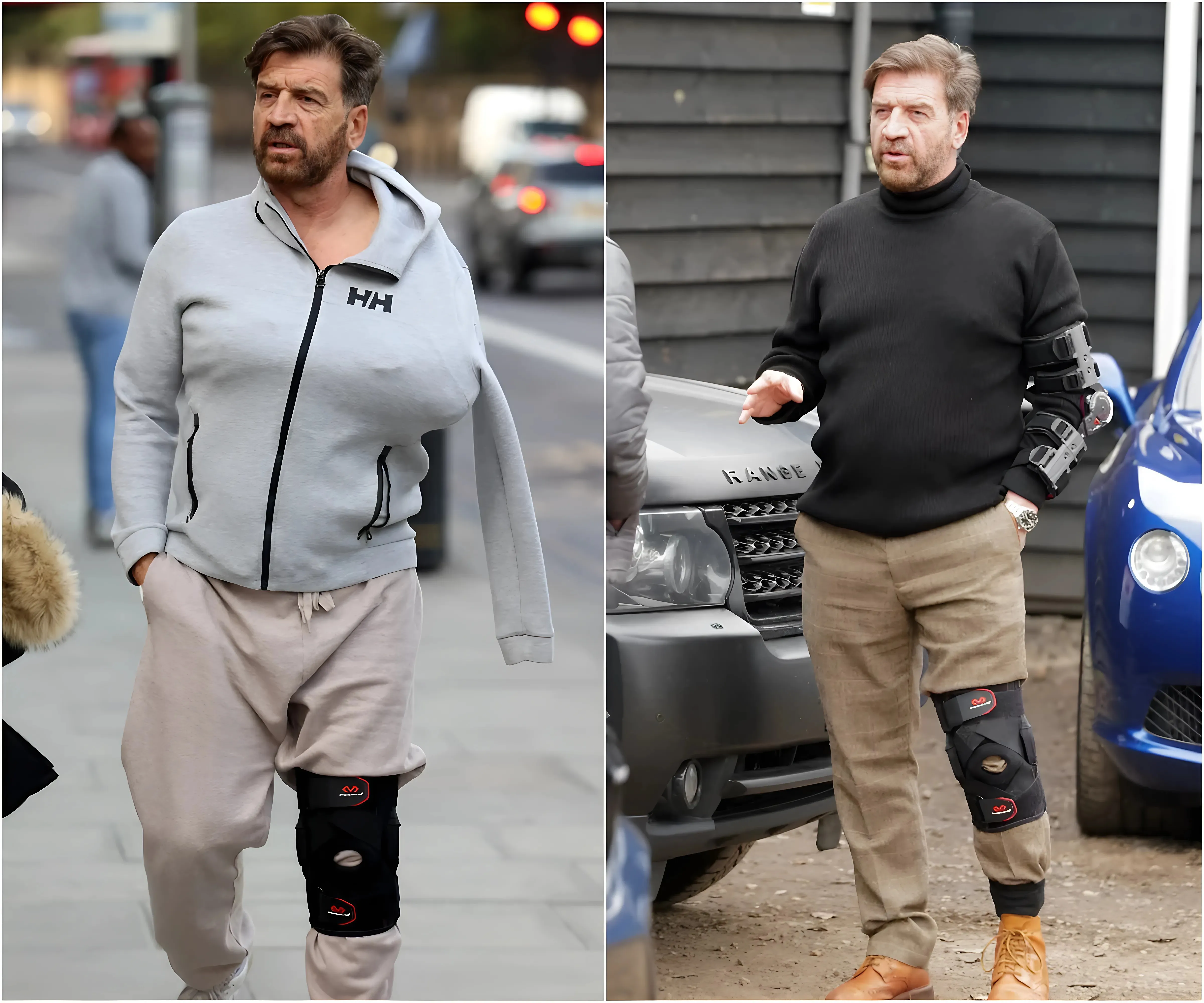 Strictly’s Nick Knowles reveals agonising show injury will take NINE months to recover from as he opens up on operation - suong