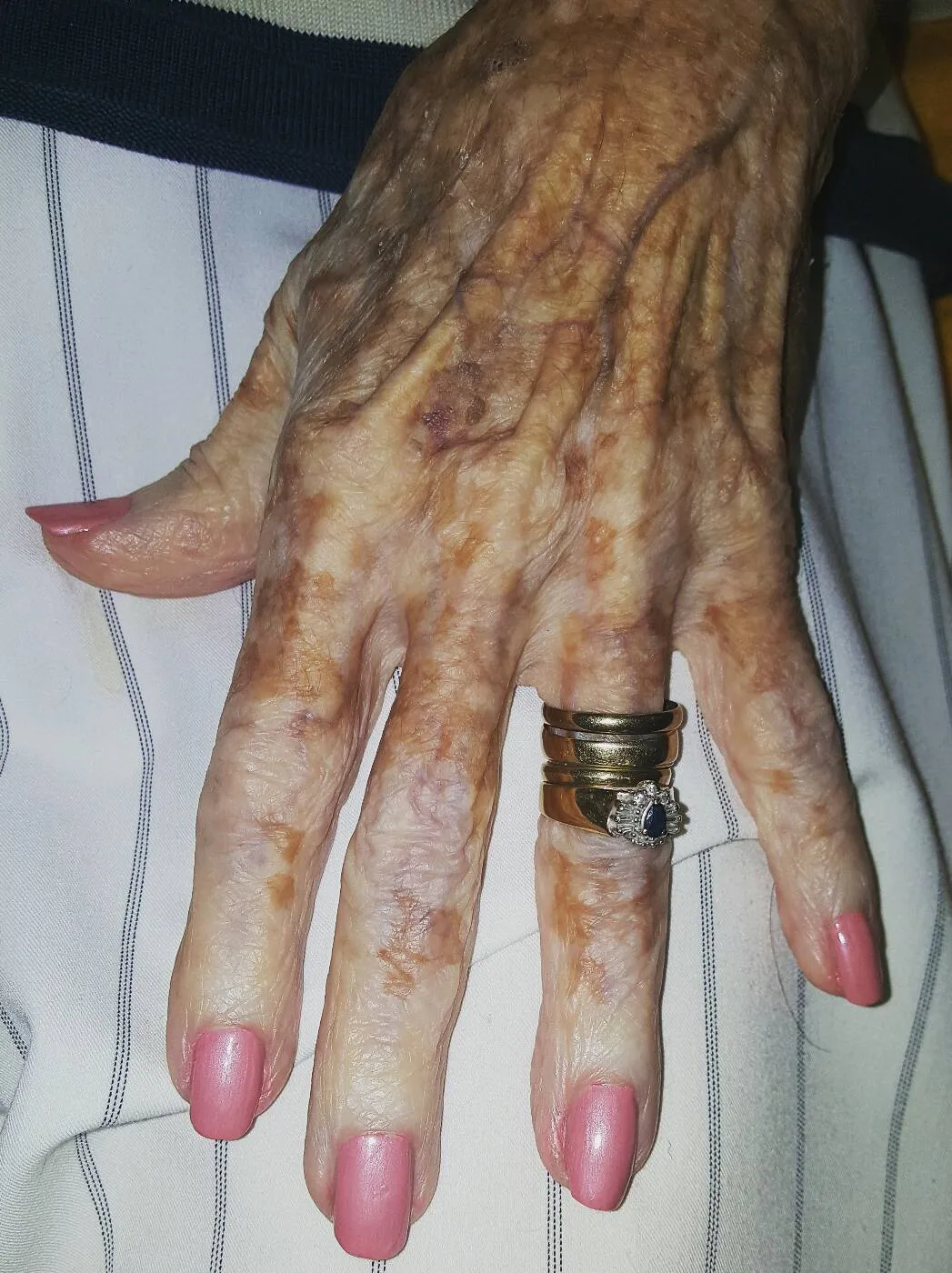 5. Nurse takes photo of old lady's hand – hidden detail in the image has the internet boiling