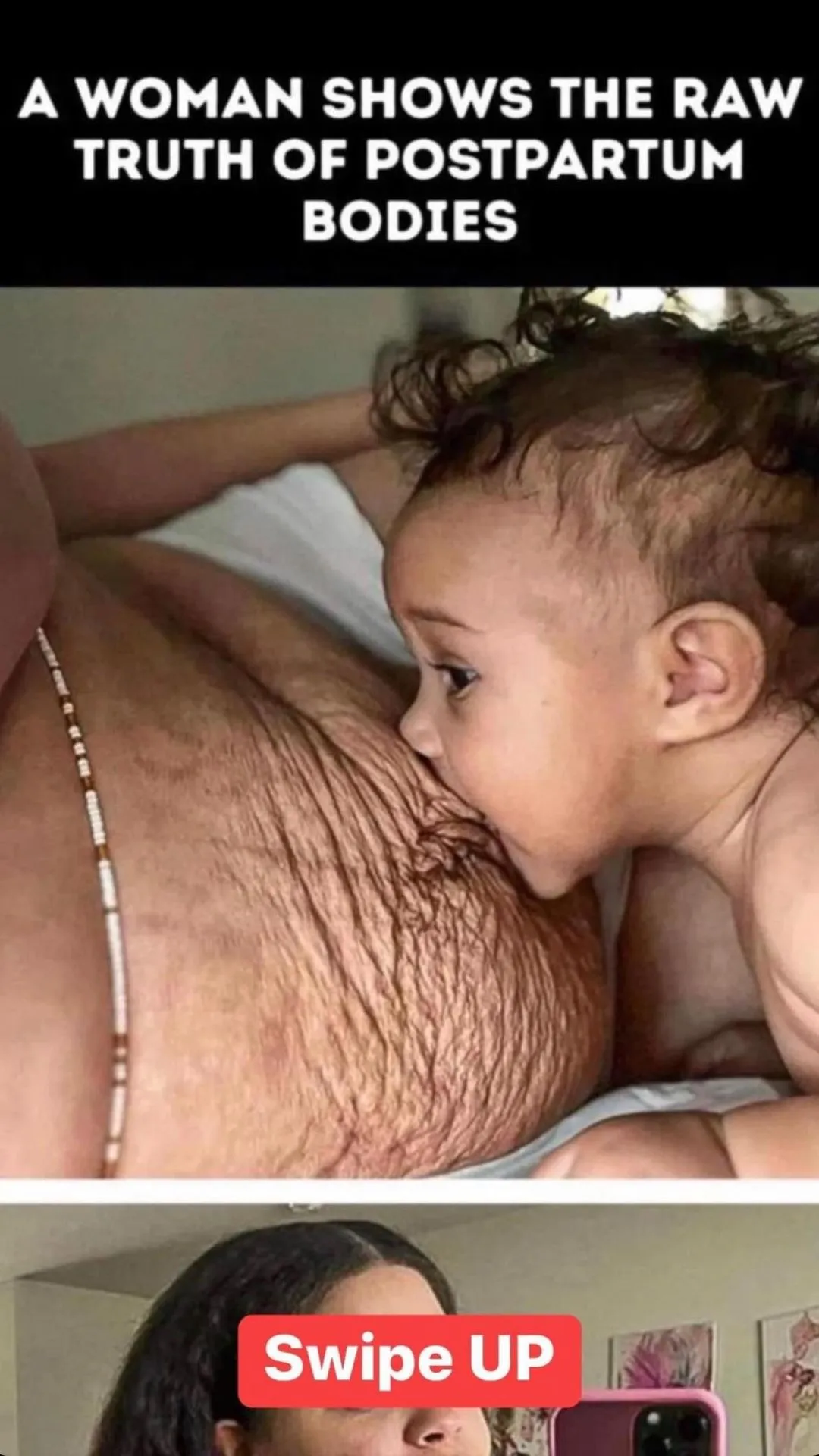 9.. Woman Shows the Raw Truth of Postpartum Bodies