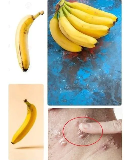 See what happens to your body if you eat bananas every day