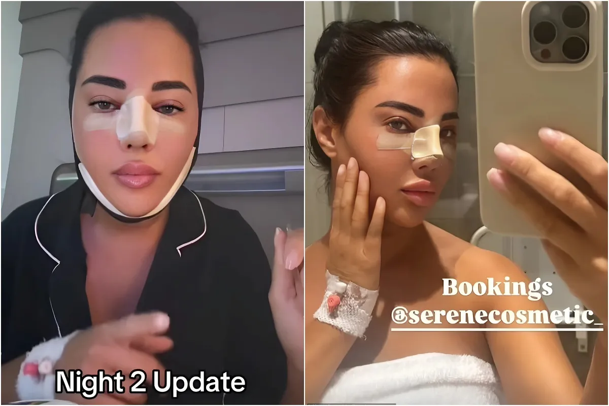 Yazmin Oukhellou shows off her 'sore' bandaged face as she gives an update after her latest £5,900 cosmetic surgery in Turkey liennhi