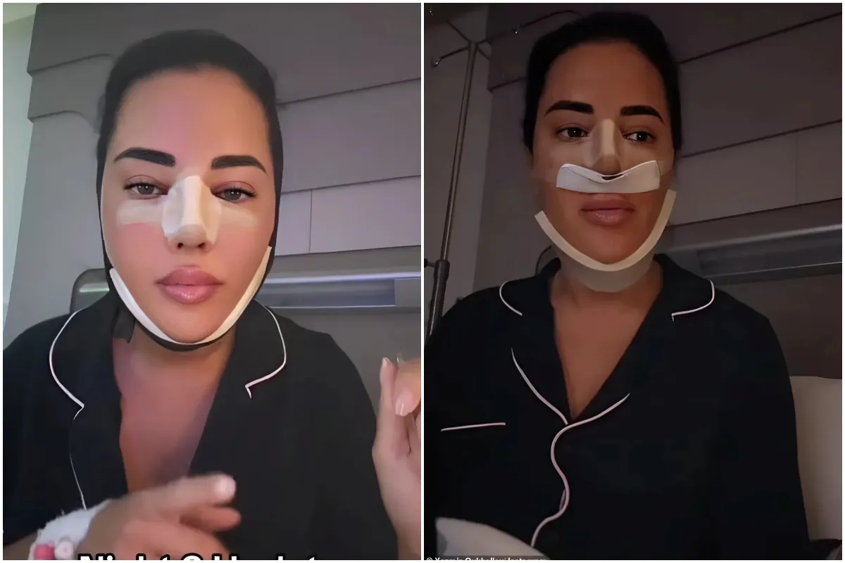 Yazmin Oukhellou shows off her 'sore' bandaged face as she gives an update after her latest £5,900 cosmetic surgery in Turkey ngocc