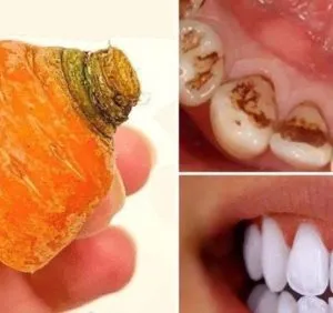 P1. Natural Teeth Whitening with Carrot Tops