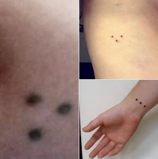 9. Red Dots on Your Skin…