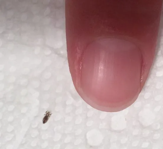 5. If you find this bug in your hair, you must read this