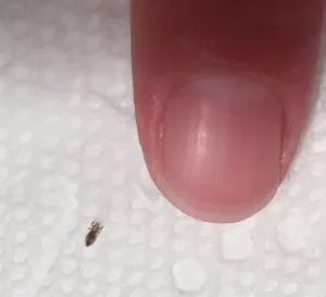 P1. If you find this bug in your hair, you must read this