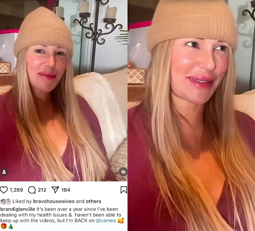 Brandi Glanville's Latest Transformation Sparks Buzz: Fans React to Her Cameo Return and Discuss Plastic Surgery Speculations - lulu